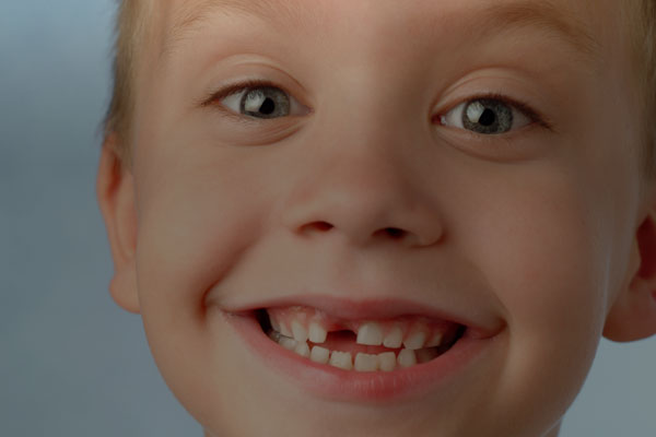 Pueblo West Neighborhood Dental & Implants